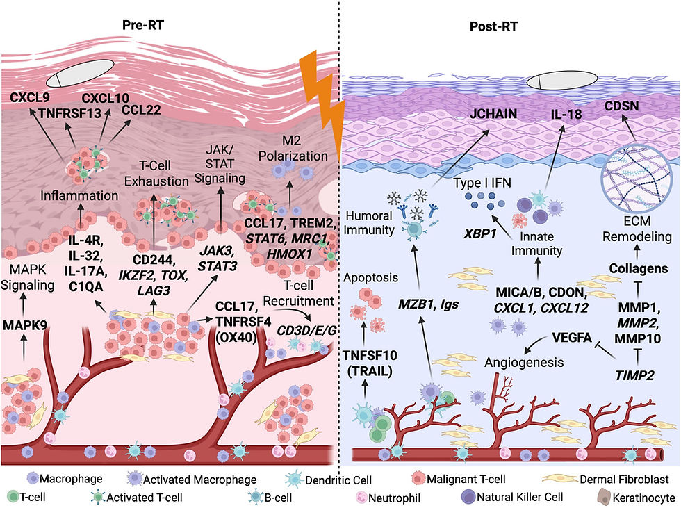 Impact of radiotherapy on CTCL immune environment characterized