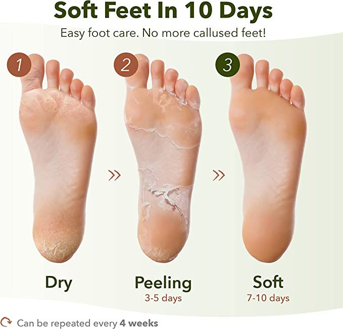 Thumbnail: Foot Peeling Mask Set By Purederm - Exfoliating Foot Peel Spa Mask-3pair