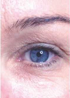 Lorna Cox Aesthetics, Port Glasgow, Facial aesthetics including SkinPen, polynucleotides and lip fillers