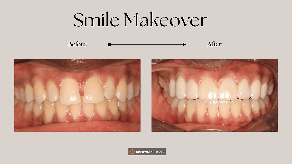 SM6-Empower Your Smile — BG Image