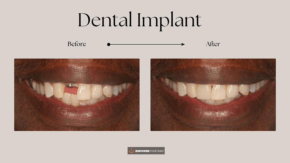 DI-Empower Your Smile — BG Image