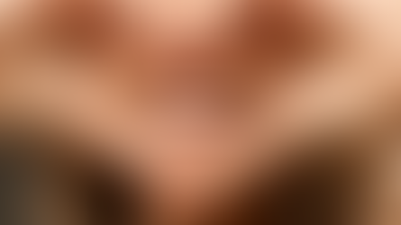 How Your Teeth and Bite Shape the Lips and Support Your Smile