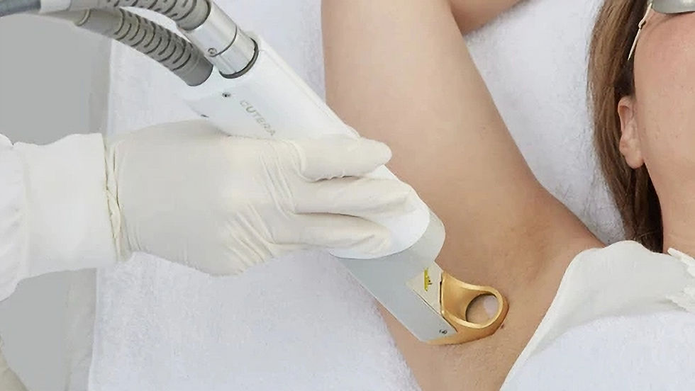 The Physics of Permanence: Medical Laser Science vs. Consumer IPL