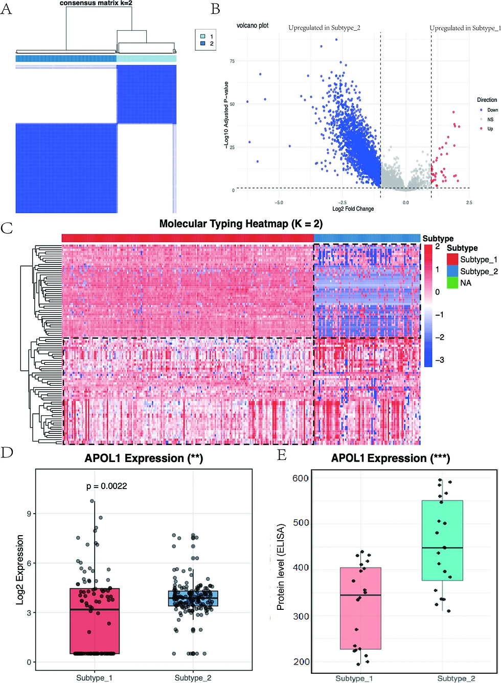 Proteomics heatmap, volcano plot and APOL1 boxplots separating two lupus nephritis molecular subtypes