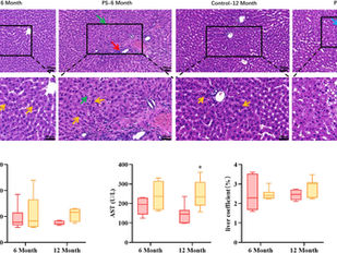 Microplastics and the Liver: Lipidomics Reveals Polystyrene’s Signature