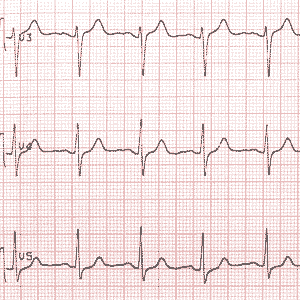 LT1_15.gif