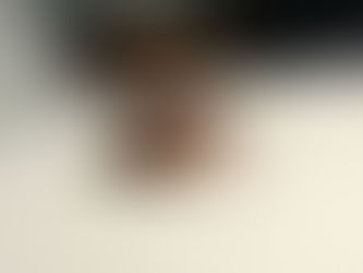 Bedwantsen Bestrijden: Herken het "Ontbijt-Lunch-Diner" patroon en onze Schiphol-service