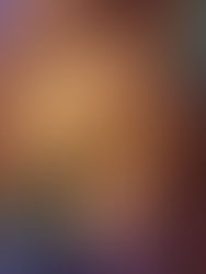 310