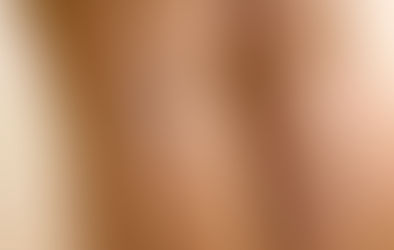 Telangiectasias: não é apenas tratar um vasinho!