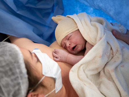 How Home Birth Reduces the Risk of Cesarean Section: Embracing Natural Birth and Lower Intervention Rates