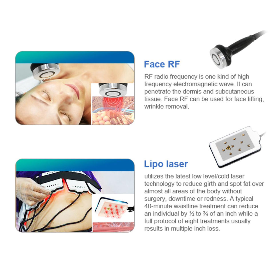 Thumbnail: Cosderma 360° Angle Surrounding Cryolipolysis Slimming Machine