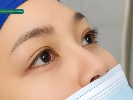 Cắt Bọng Mắt Giá Bao Nhiêu? Bảng Giá Chi Tiết