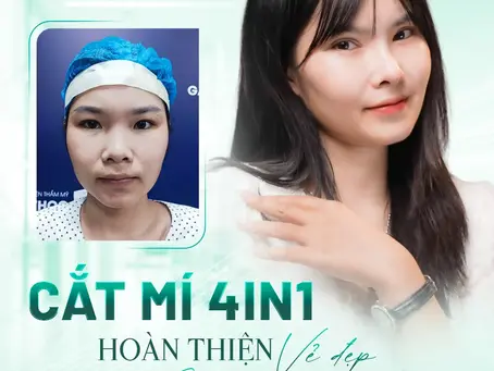 Phụ Nữ Mang Thai Có Nhấn Mí Được Không?