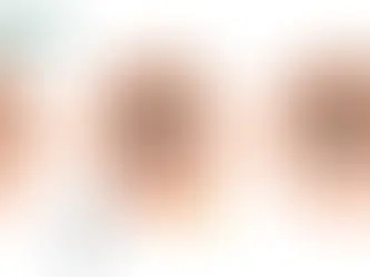 Cắt Bọng Mắt Có Đau Không? Giải Đáp Chi Tiết