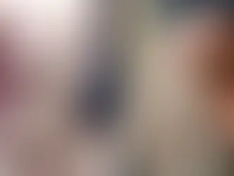 Nâng Mũi Xong Bị Chảy Máu: Nguyên Nhân, Cách Xử Lý