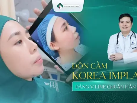 Phẫu Thuật Độn Cằm: Bí Quyết Kiến Tạo Gương Mặt V-Line Hoàn Hảo