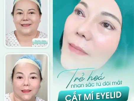 Cơ Địa Sẹo Lồi Có Nên Cắt Mí Không? Giải Đáp Từ Chuyên Gia