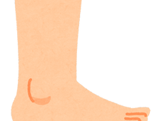 小児扁平足とは?