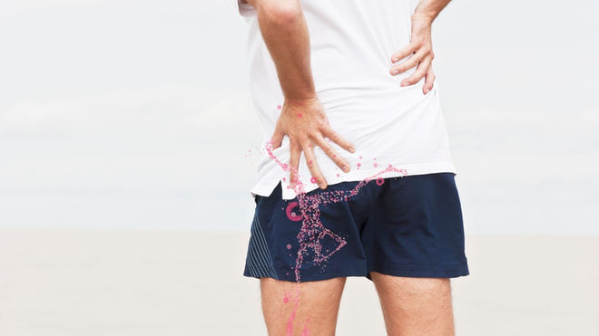 Can Tight Hips Cause Lower Back Pain?
