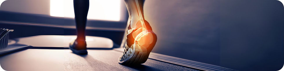 Image of a person walking with a graphical overlay over their feet representing inflammation of the heel.