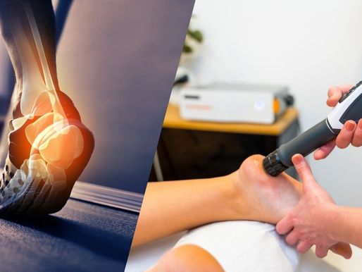 Shockwave Therapy and Foot Pain: A Breakthrough for Recovery