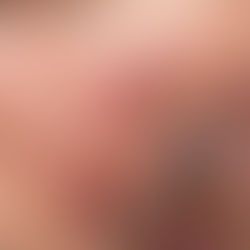 How To Repair Skin Barrier? 