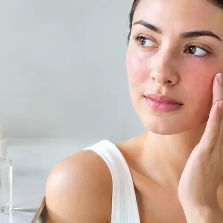 Can Niacinamide Irritate Sensitive Skin?