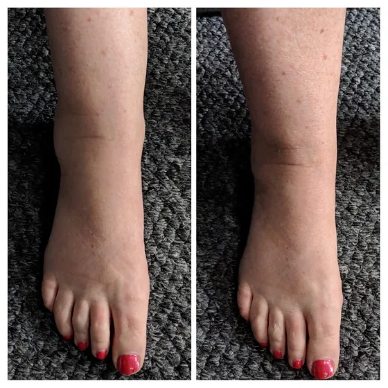 Manual Lymphatic Drainage Massage Motion