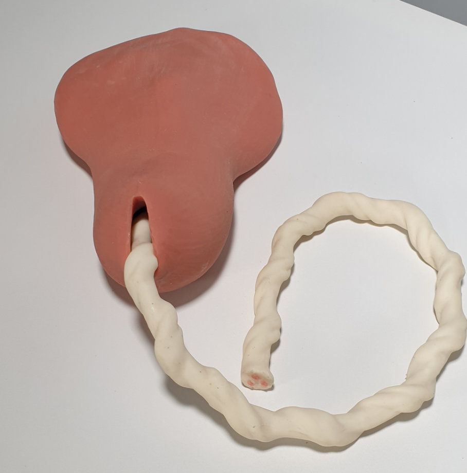 Manual Removal of the Placenta Kit