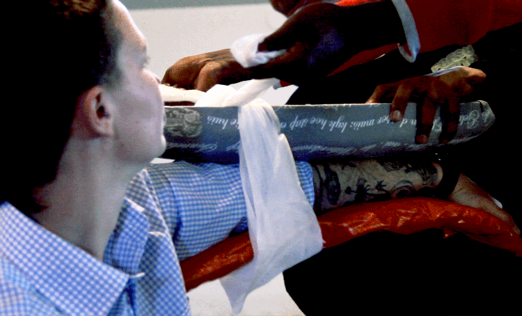 SPLINTING