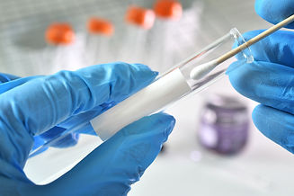 nasal-or-oral-testing-swab-being-inserted-test-tub-2022-12-08-17-23-12-utc.jpg
