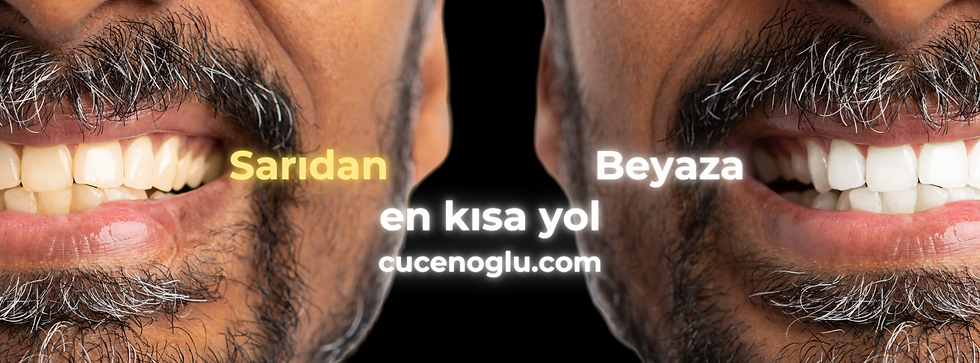 diş beyazlatma tooth whitening alp burak cucenoglu