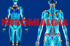 La riduzione dell'innervazione cutanea è associata a un fenotipo di fibromialgia grave