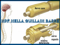 Innervazione cutanea nella sindrome di Guillain-Barré: patologia e correlazioni cliniche