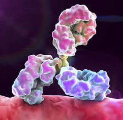 IVIg per polineuropatia delle piccole fibre apparentemente autoimmune: prima analisi dell'effica