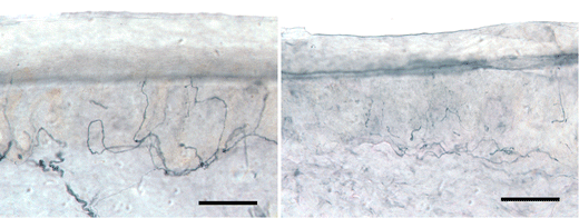 Modelli gerarchici per i dati delle fibre nervose dell'epidermide