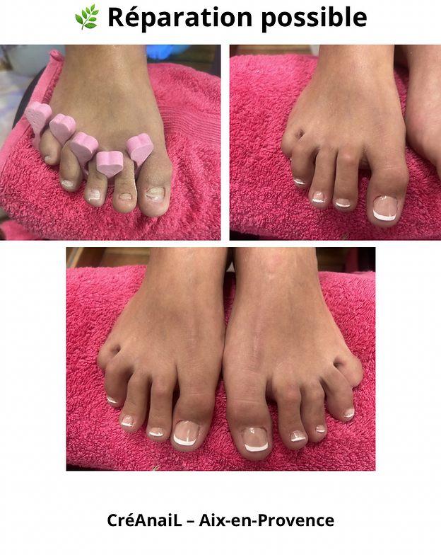 reparation-ongle-gel-creanail-aix-en-provence-possible.PNG
