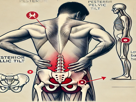 How Poor Posture Leads to Posterior Pelvic Tilt: Chiropractic Tips for Realignment