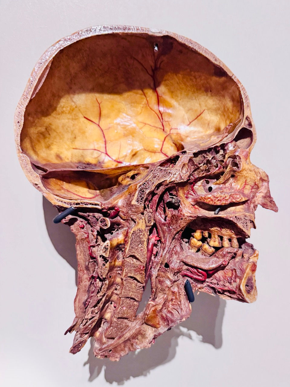 GöttwAIg - EXKURS: Wunderkammer George Loudon Collection VENEDIG