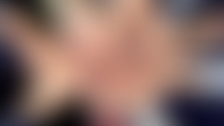 Consenso en la UGC Camas. PVA 2018 (VPH, Varicela y MeninC)