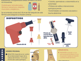 Serie Infografías: Vía Intraósea