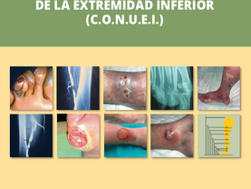 Consenso en el abordaje de las úlceras de la extremidad inferior
