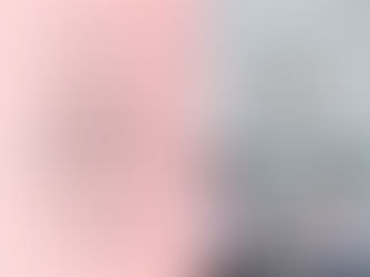 ミラドライダブル照射モニター募集