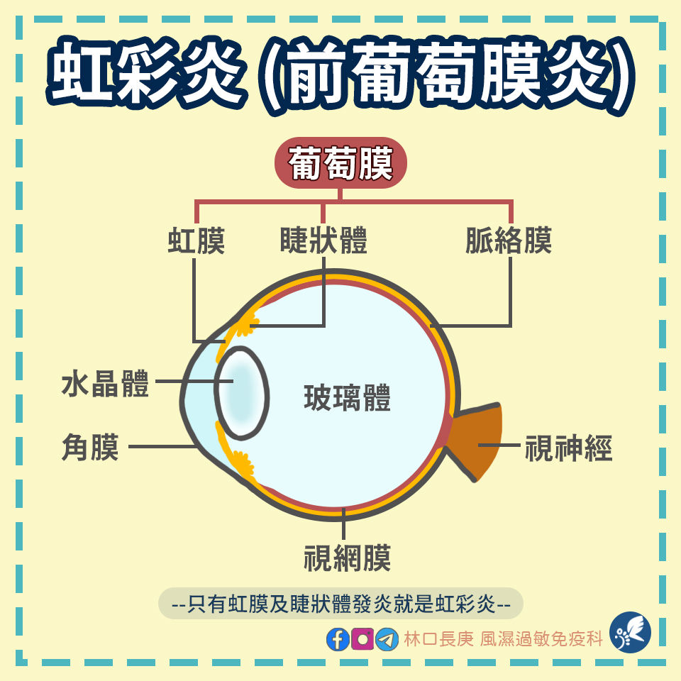 眼睛紅、痛、畏光 只是小事嗎 ️ | My Site