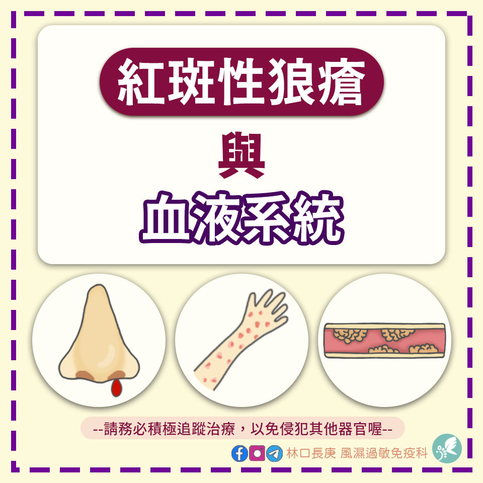 紅斑性狼瘡 與 血液系統🩸 | My Site