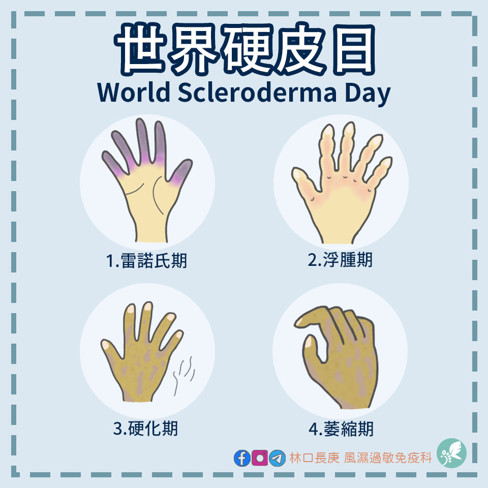 6/29🌐世界硬皮日🌐World Scleroderma Day | My Site