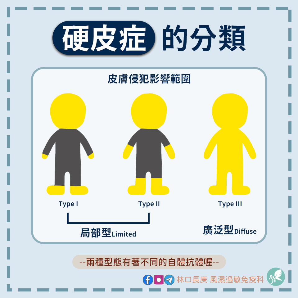 硬皮症的分類 | My Site