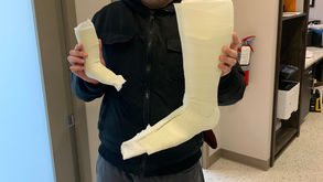 Walking into the World of AFOs - Ankle Foot Orthotics