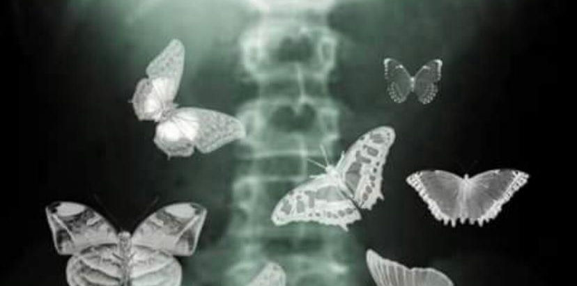 Mariposas en la panza