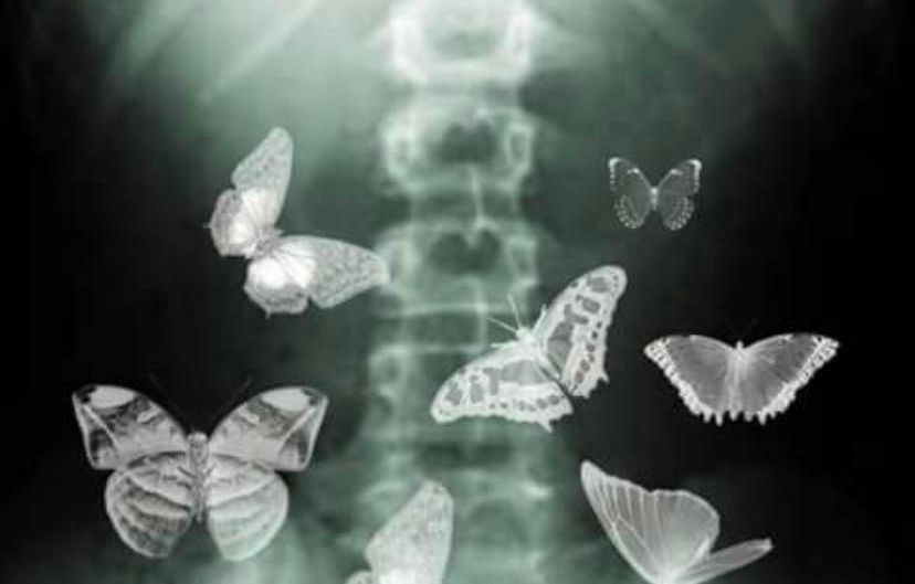 Mariposas en la panza